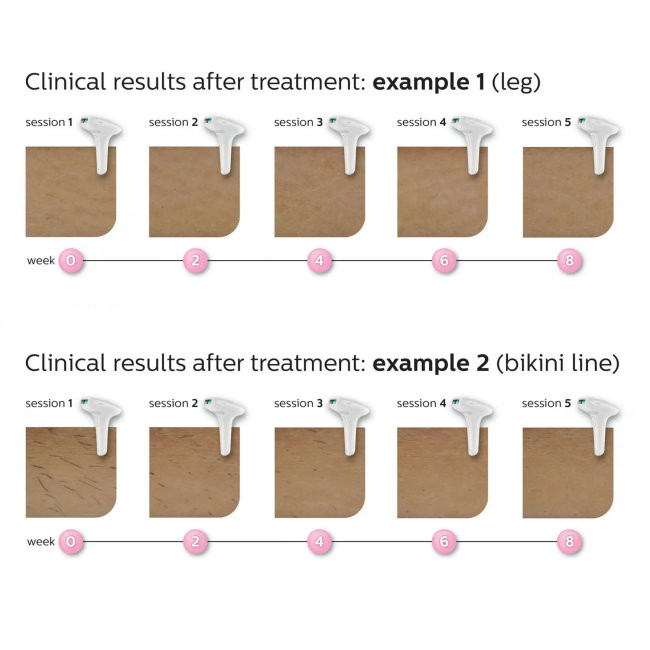 Epilator PHILIPS IPL LUMEA SC1997/00